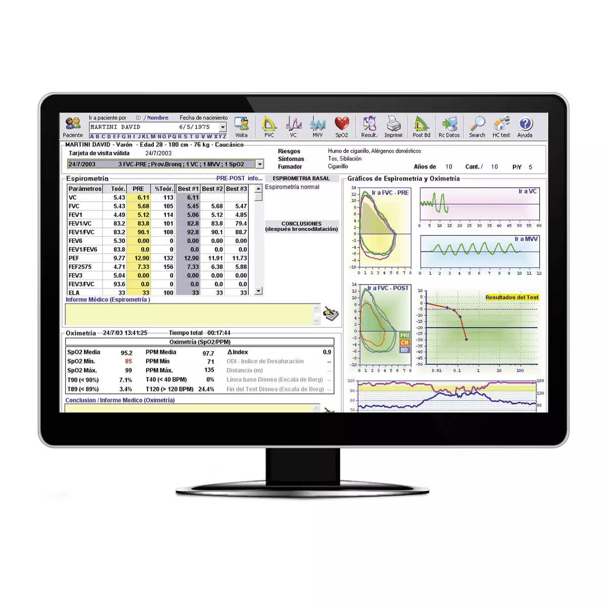  Minispir PC spirometer