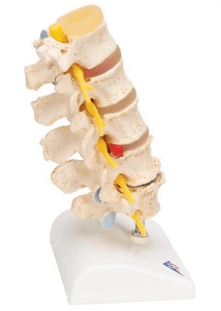  Herniated Disc