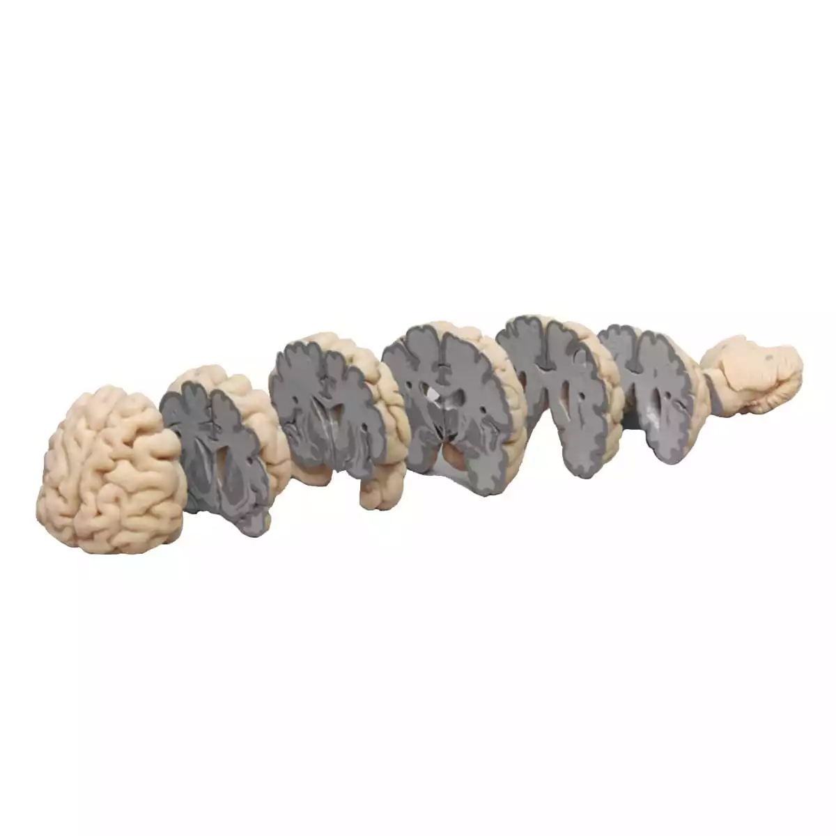  Human brain in frontal sections