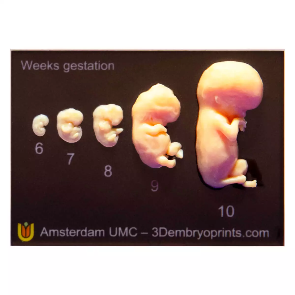 Embryo models – 6th to 10th week of pregnancy Embryo models – 6th to 10th week of pregnancy