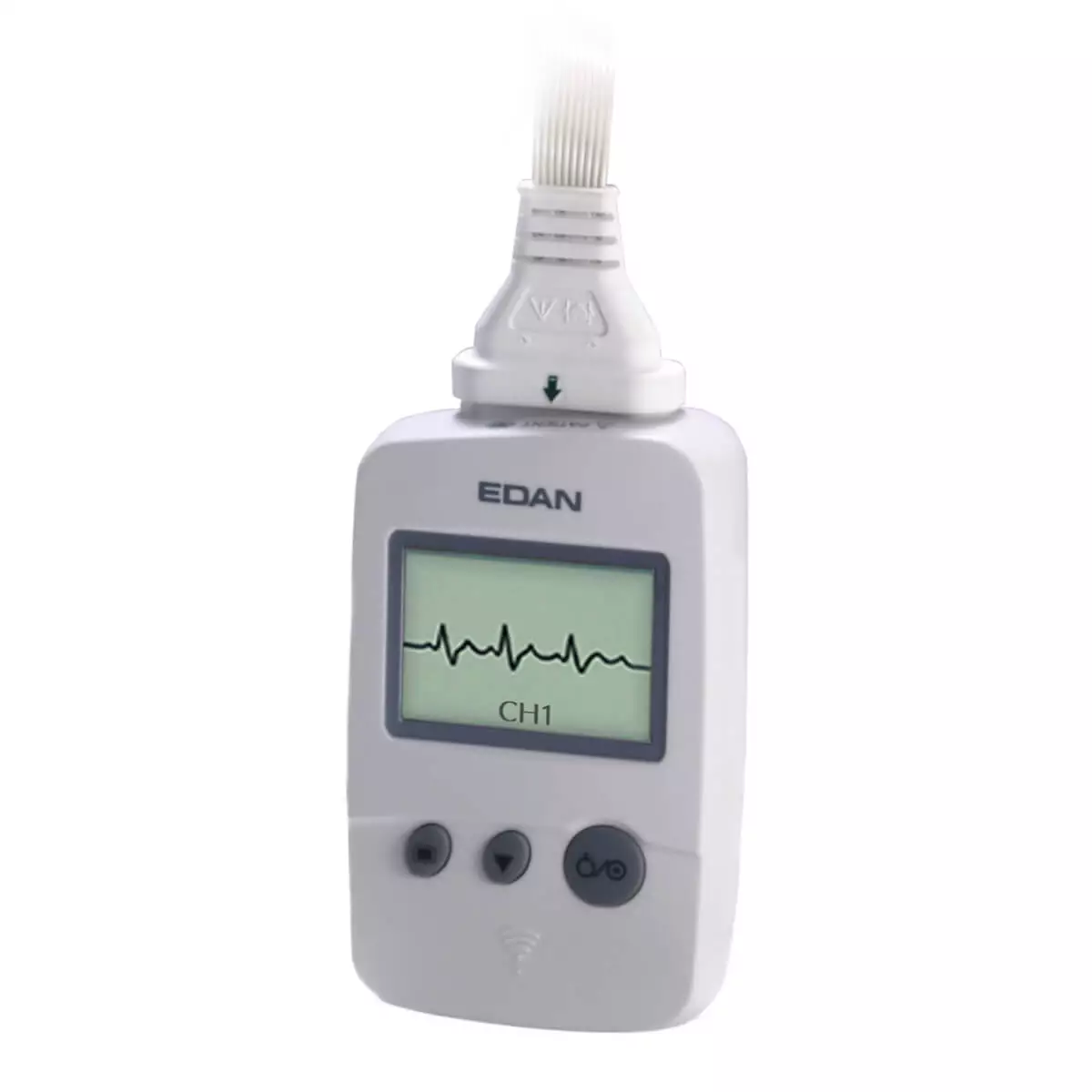 Buy EDAN SE-1515 ECG data management software With DX12 Sampling Box online