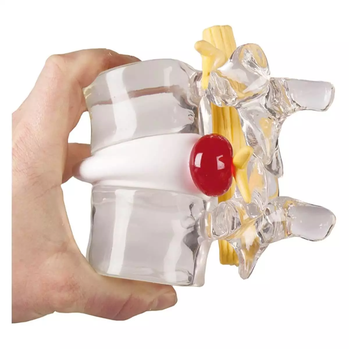  Herniated disc simulator