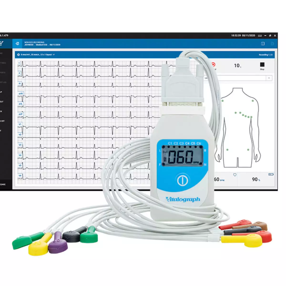  BT12 resting ECG with Bluetooth connectivity