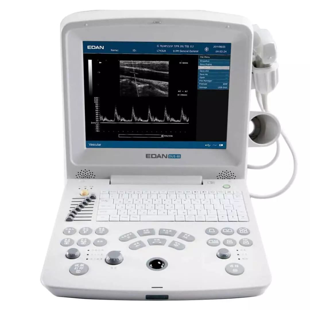  DUS 60 ultrasound scanner
