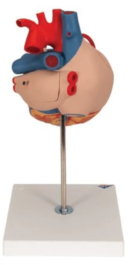  Model heart with bypass