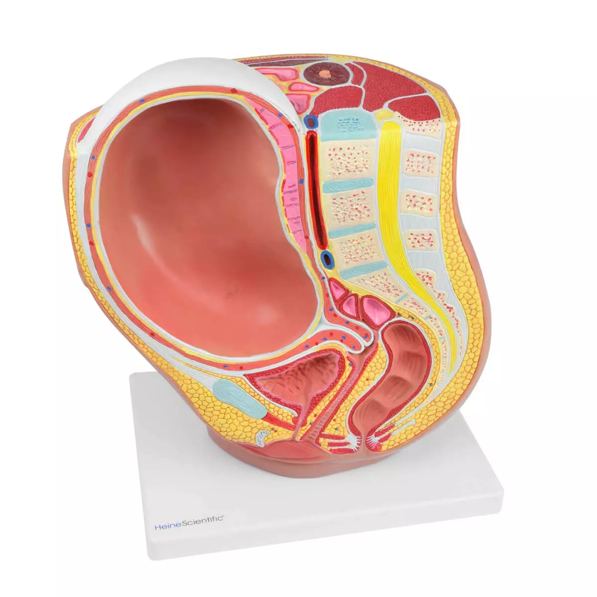  Pregnancy model with removable fetus