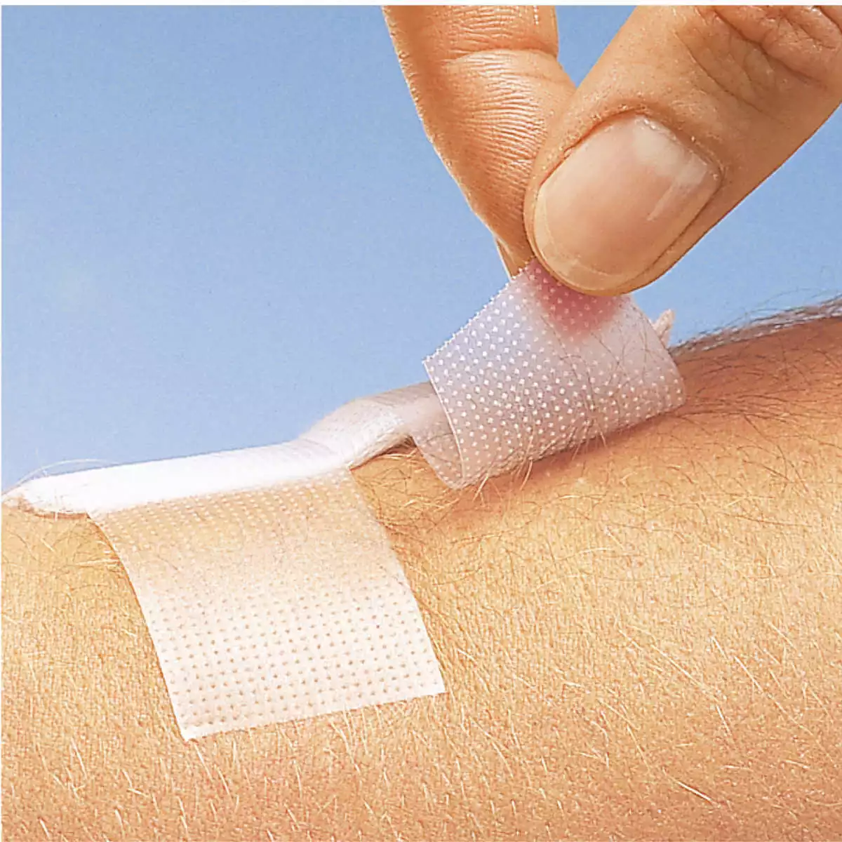  Omnifilm fixation patch