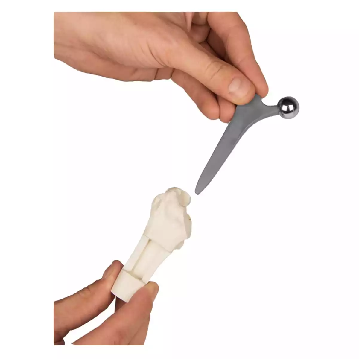 Hip implant model