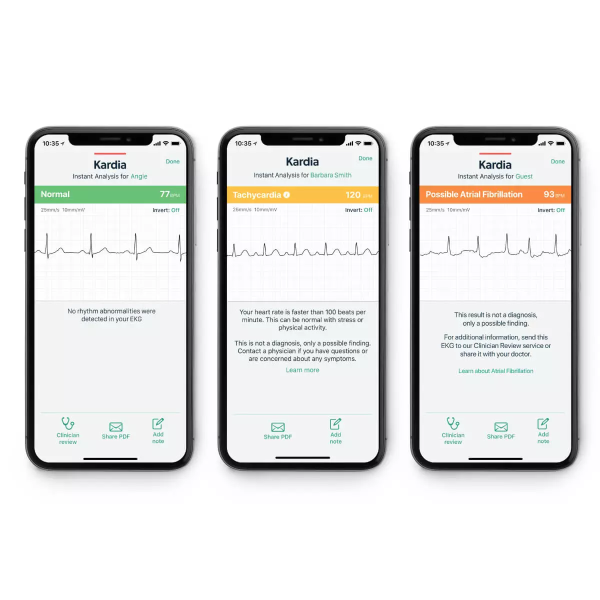  KardiaMobile® smartphone 1-channel ECG
