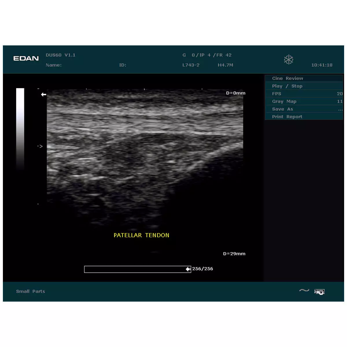  DUS 60 ultrasound scanner