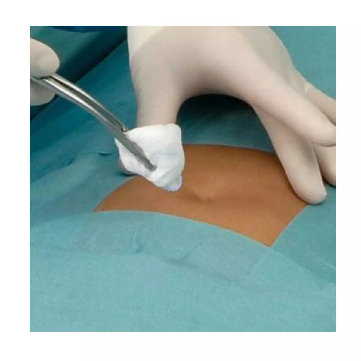  Foliodrape protect Basic Surgical Drape Set