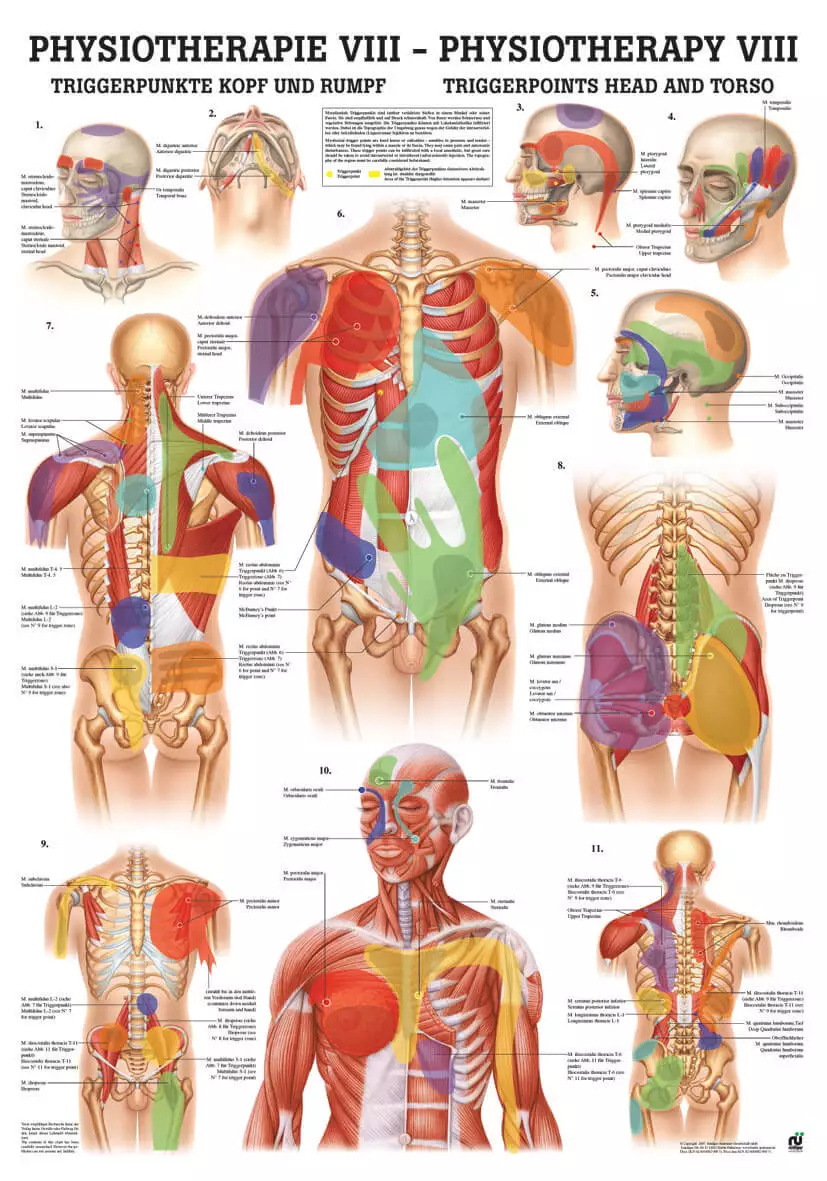  Teaching board - Trigger points head and trunk