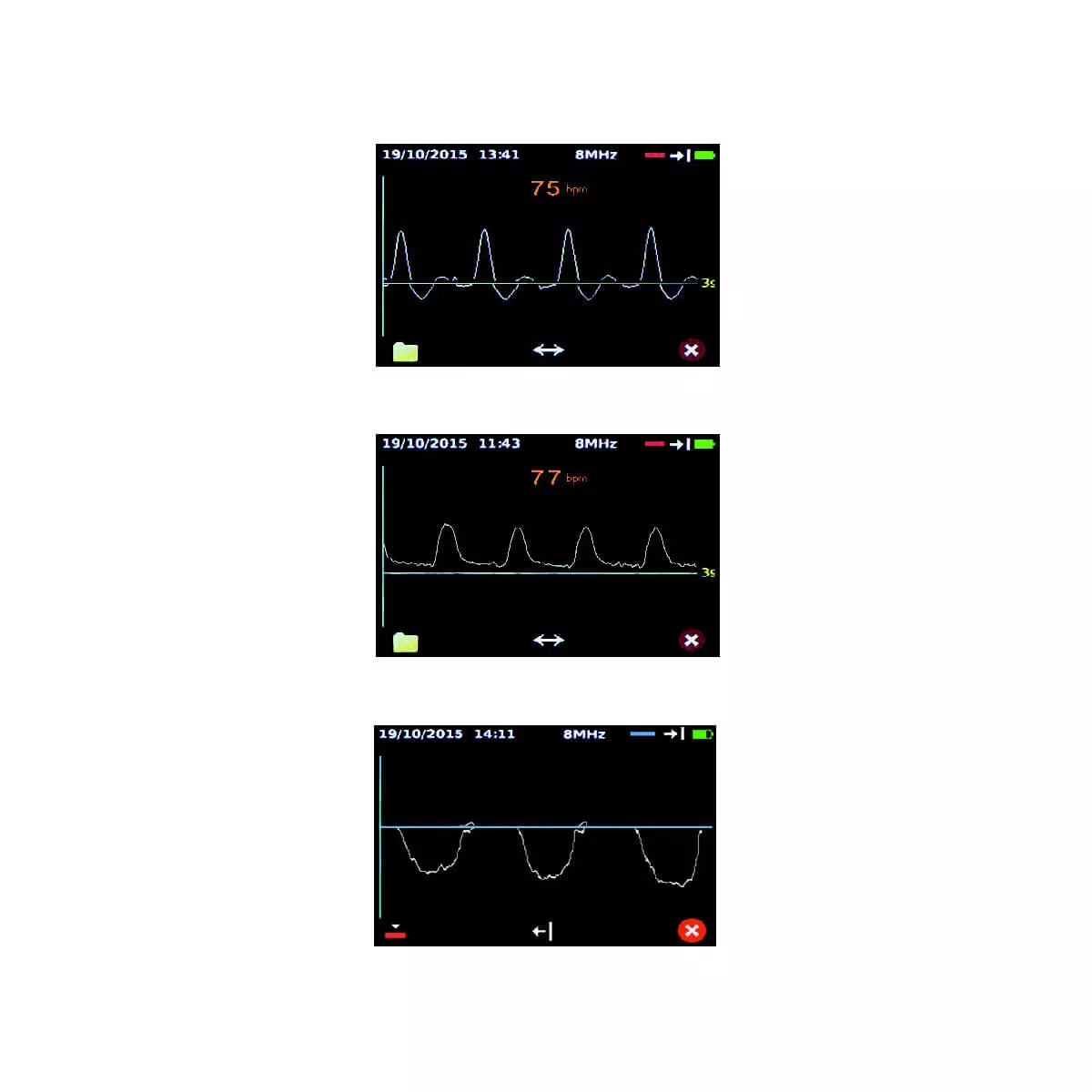  Dopplex DMX vascular doppler