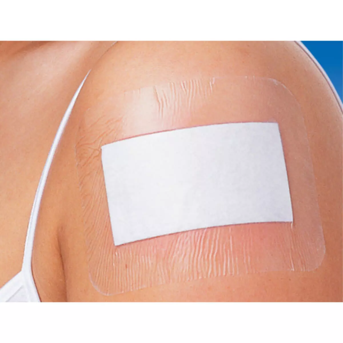  Cosmopor transparent film dressing