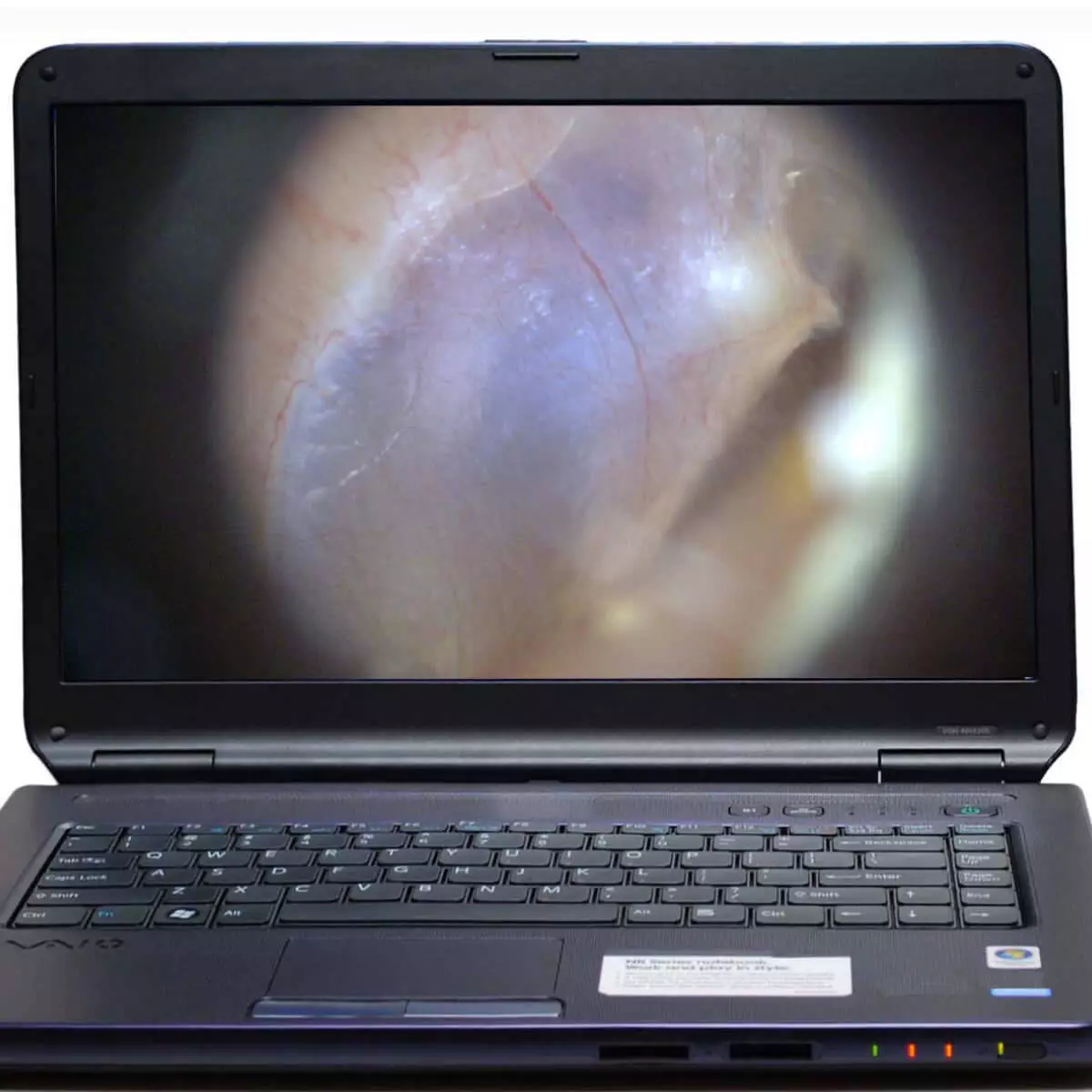  EarScope Pro wireless video otoscope
