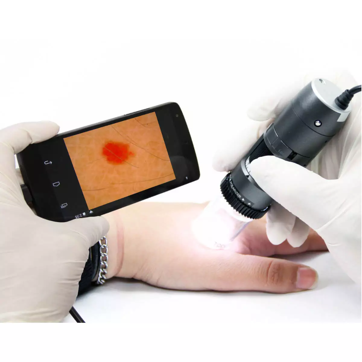  DermaScope Polarizer HR 200x video dermatoscope