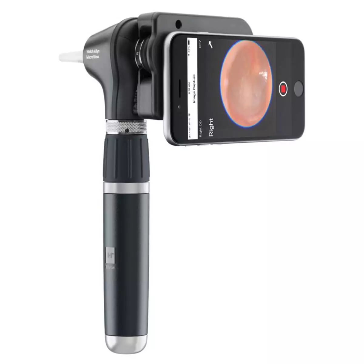  MacroView Plus otoscope head with iExaminer