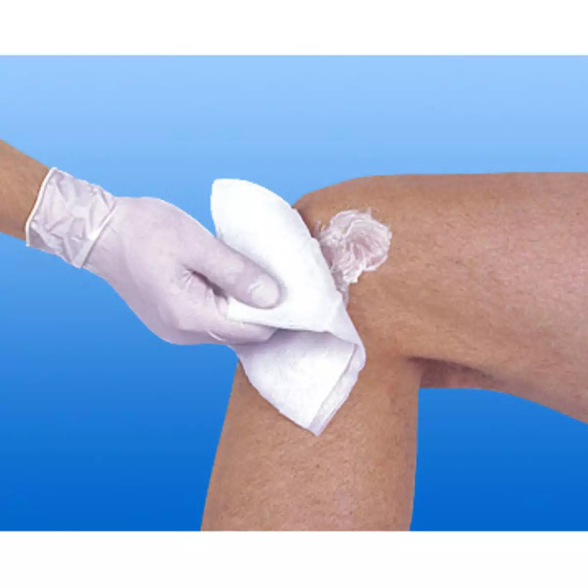  NOBAMULL gauze bandage