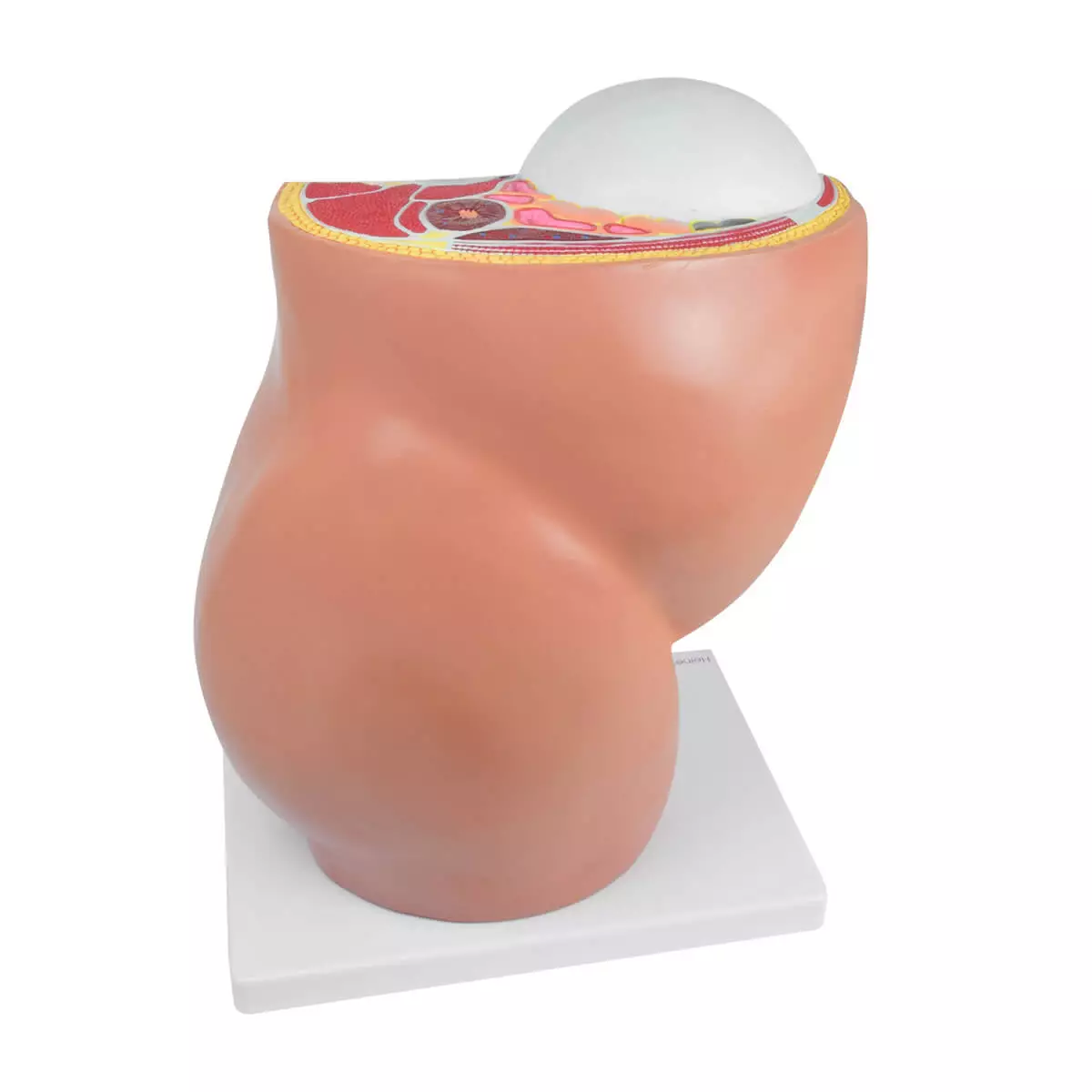  Pregnancy model with removable fetus
