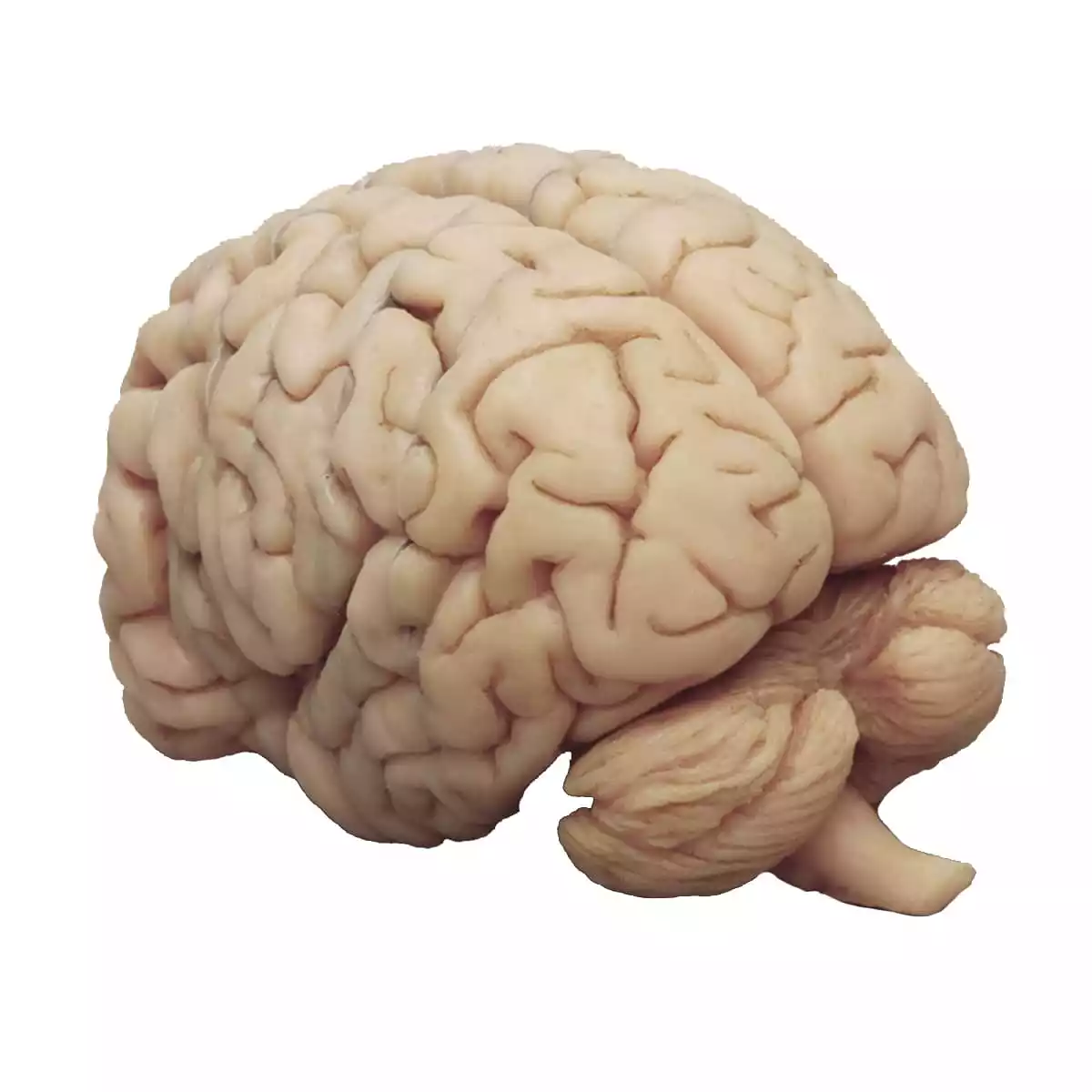  Human brain in frontal sections