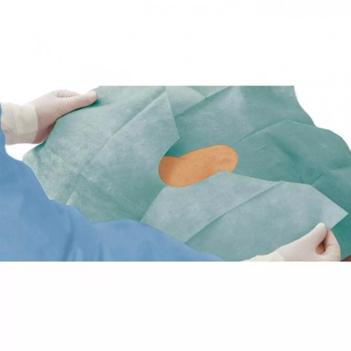  Foliodrape protect Fenestrated Surgical Drapecloths