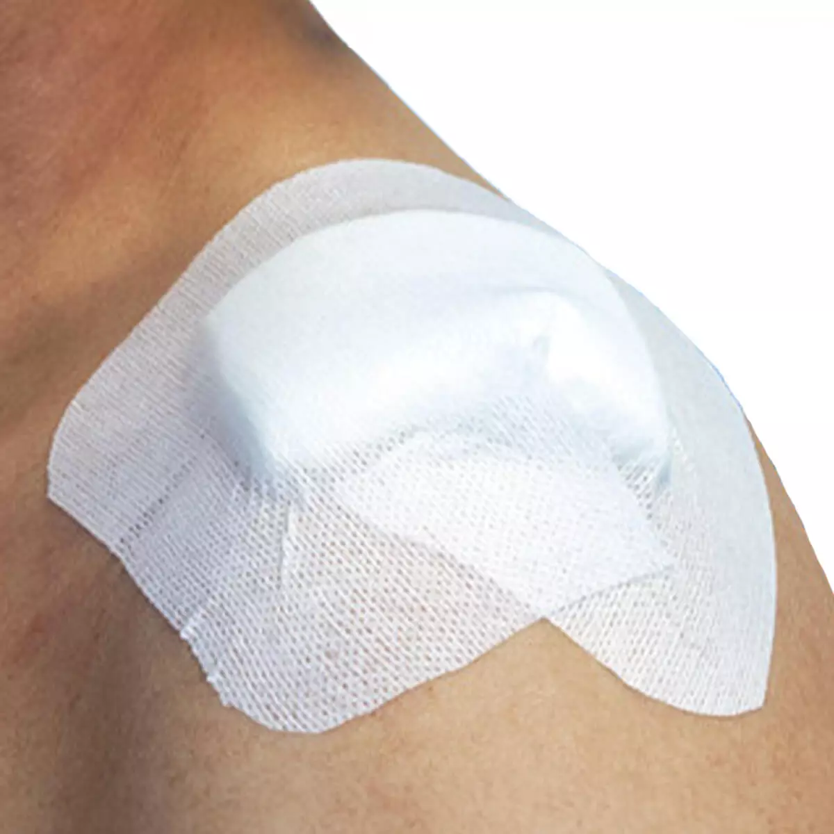  RUDAVLIES non-woven adhesive tissue