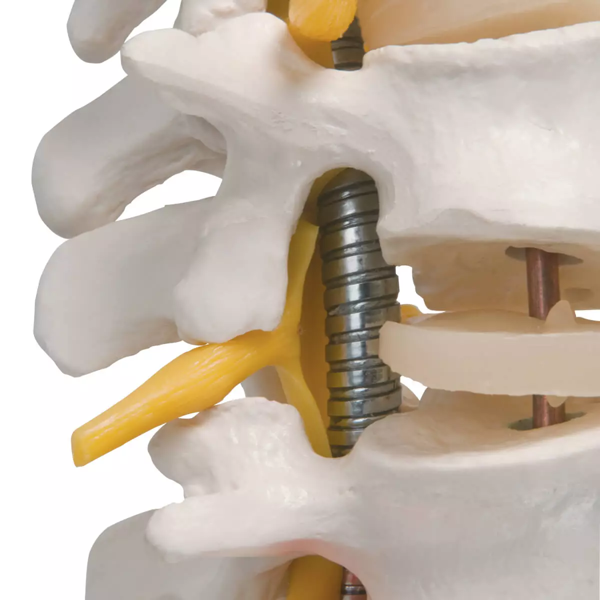  Flexible spine model