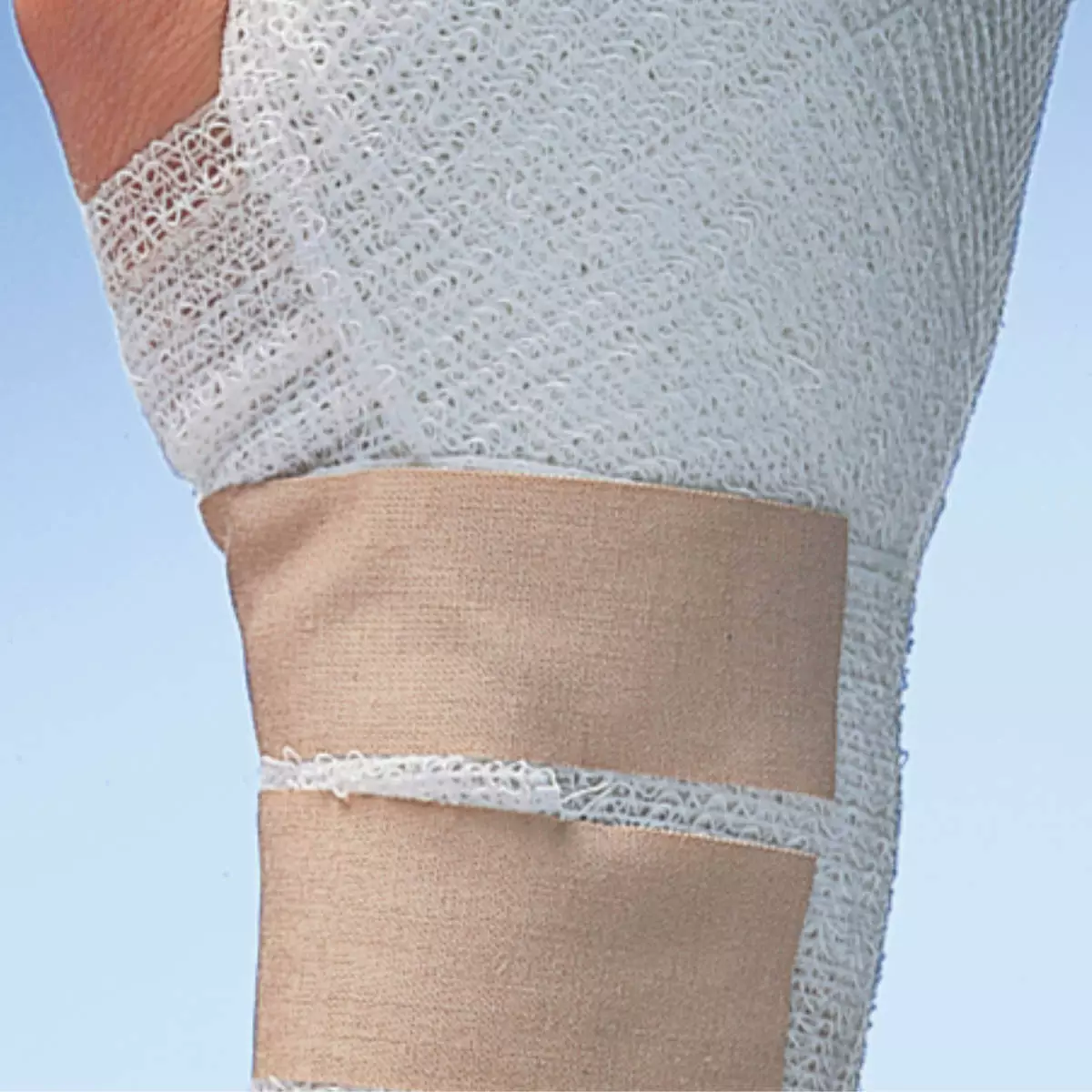  Omniplast fixation plaster