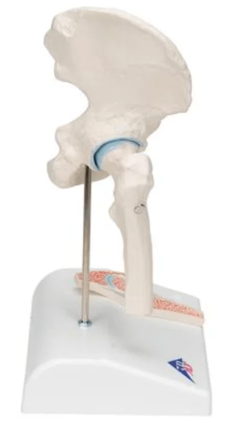  Mini model hip joint