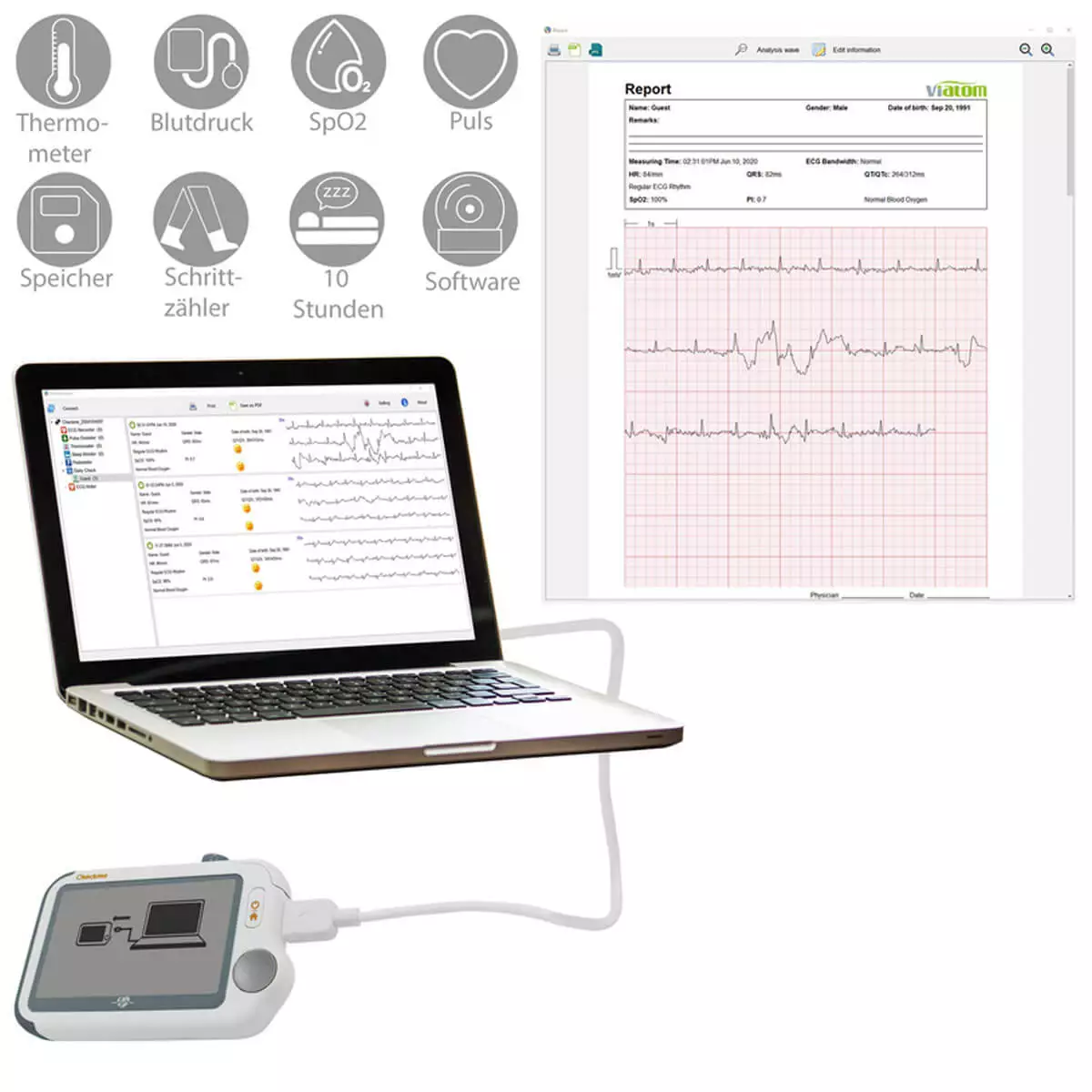 Checkme Pro by Viatom ECG Monitor Checkme Pro by Viatom ECG Monitor