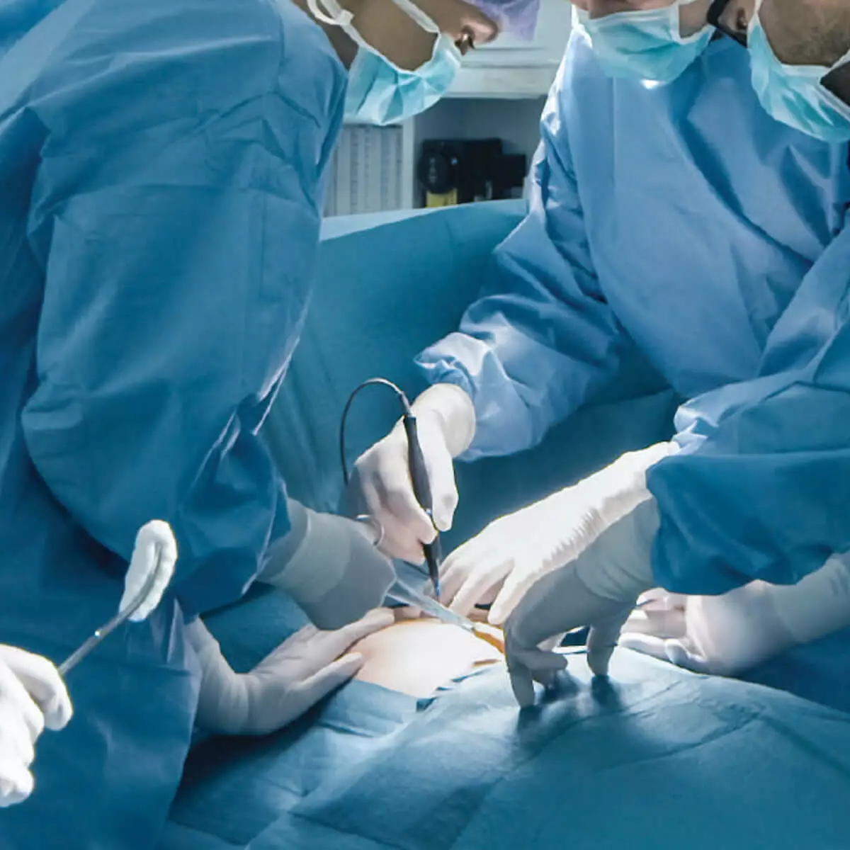 EPIC MT latex surgical gloves