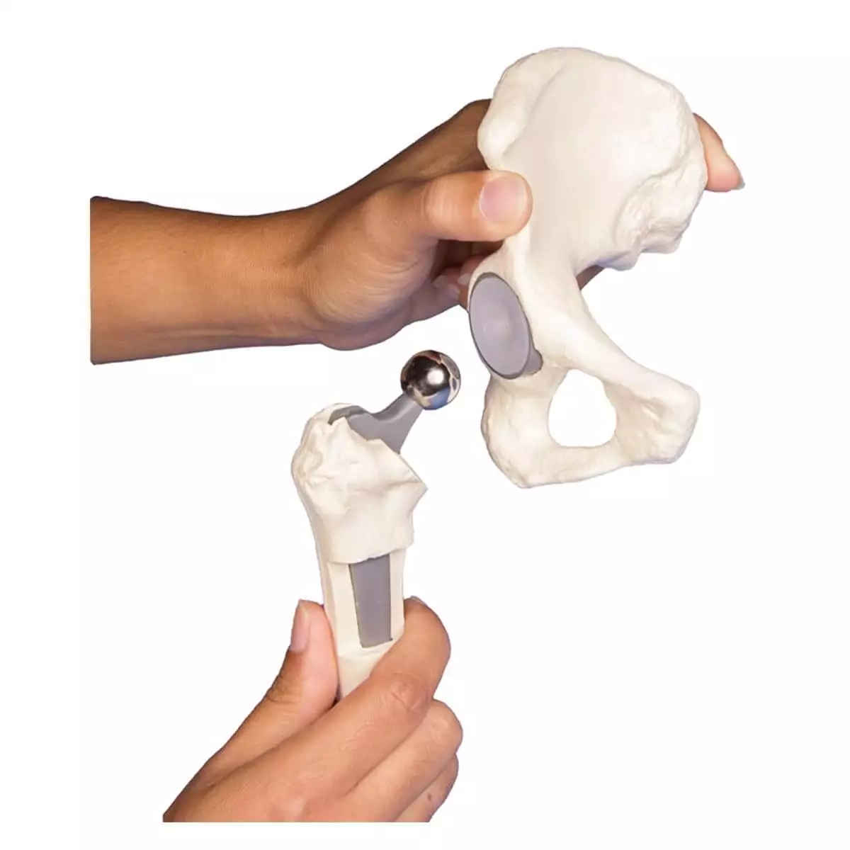  Hip implant model