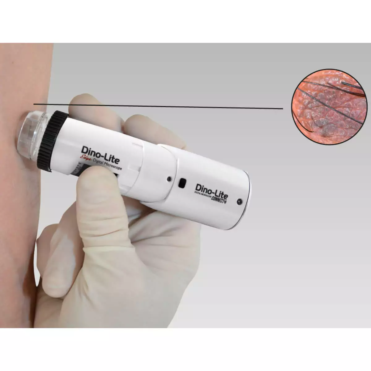  DermaScope Polarizer wireless video dermatoscope