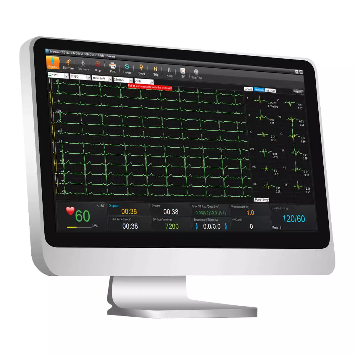  SE-1515 ECG data management software