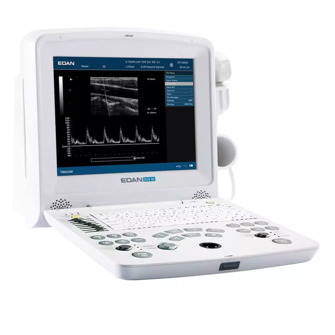  DUS 60 ultrasound scanner