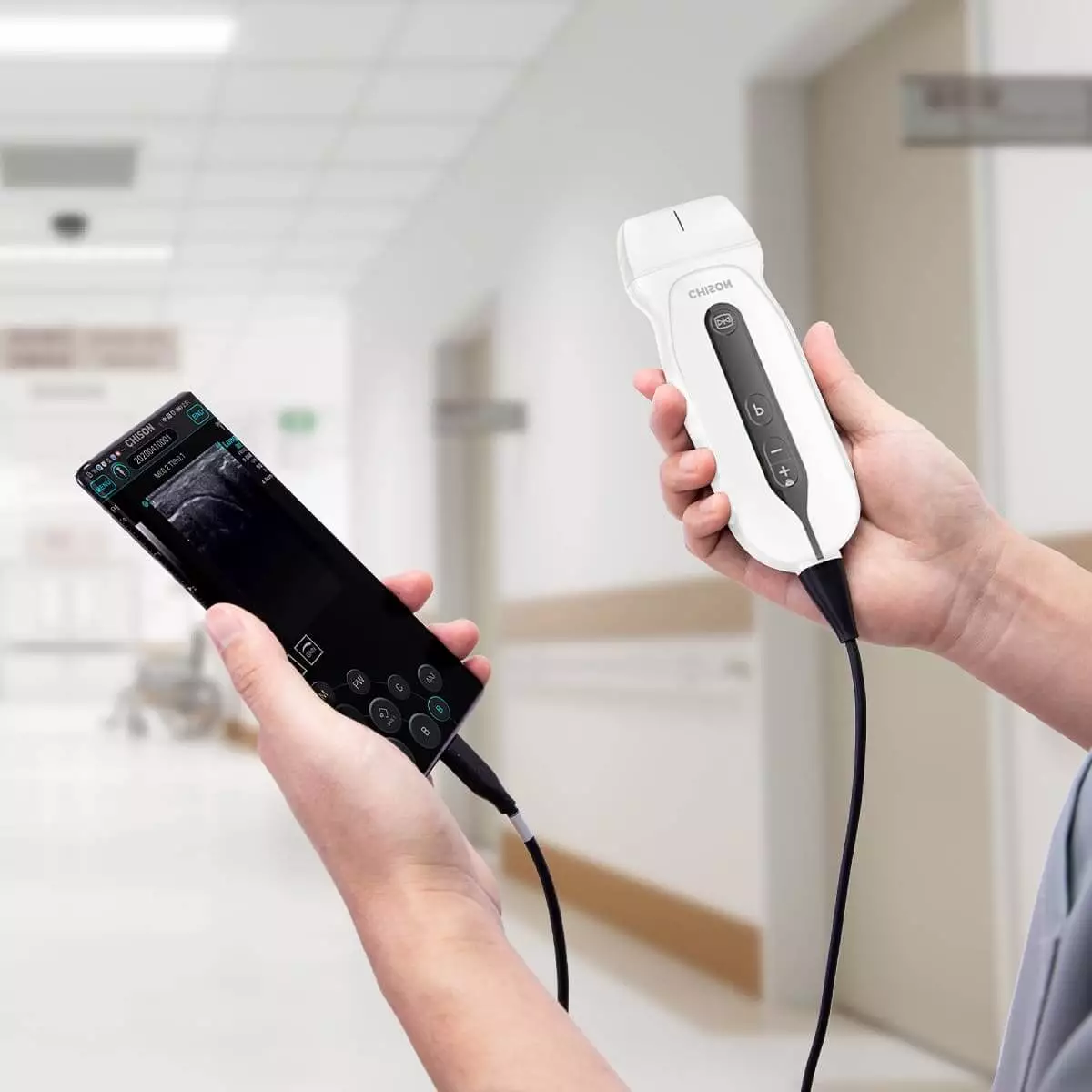  SonoEye G2 Handheld Ultrasound Scanner