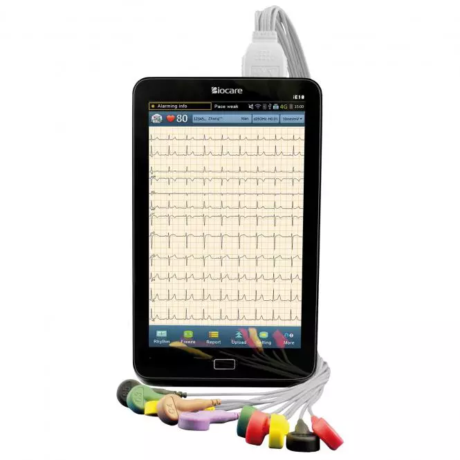  iE10 mobile ECG