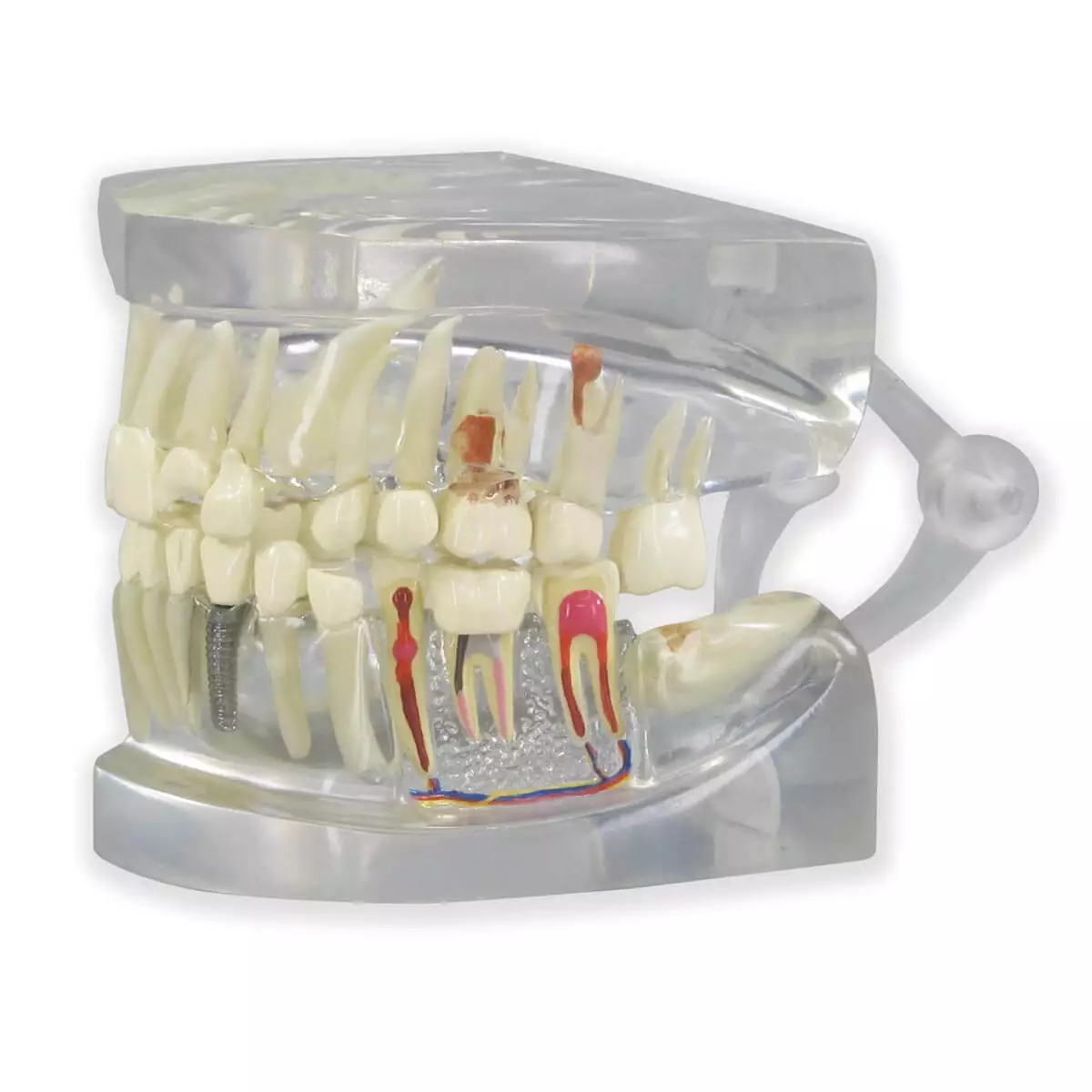 Transparent human jaw
