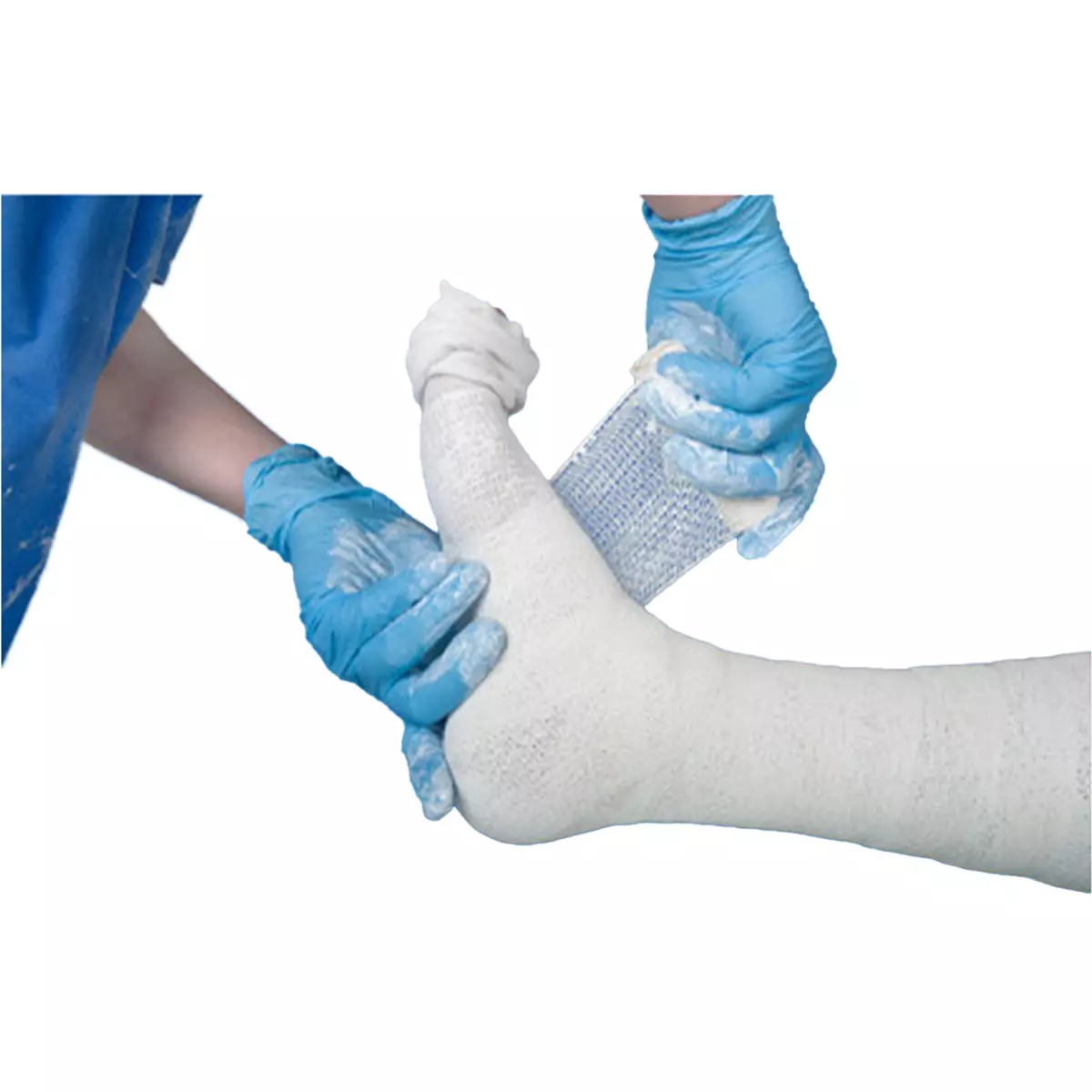  NOBAVORO zinc paste bandage