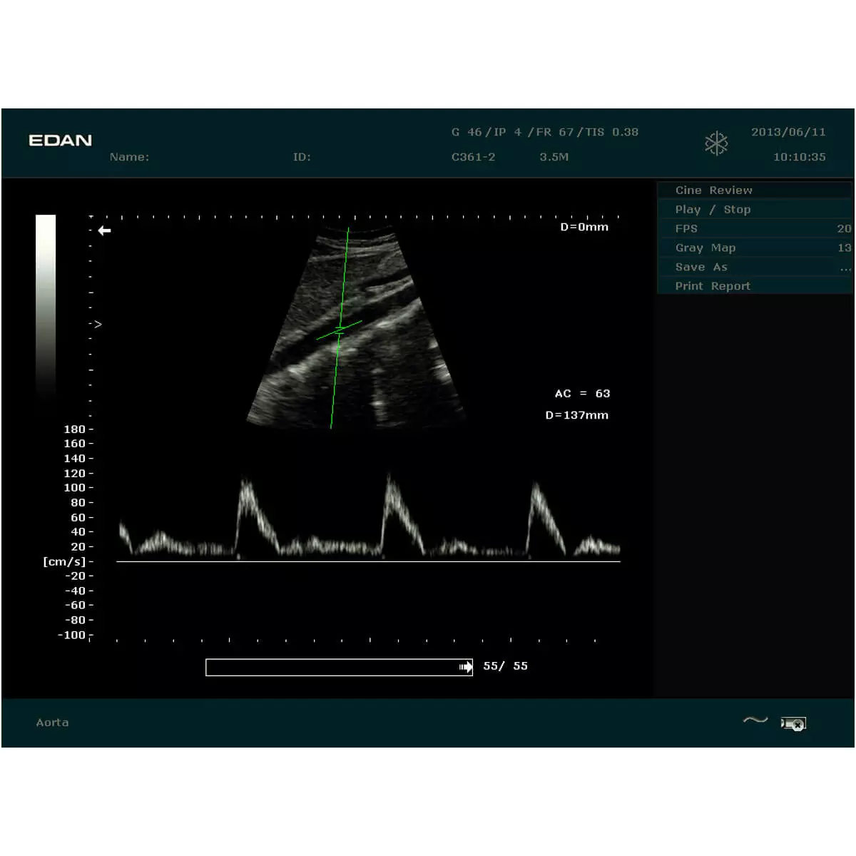  DUS 60 ultrasound scanner