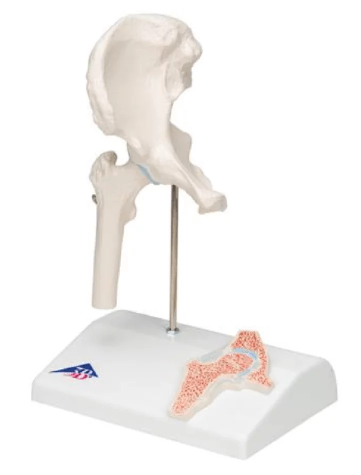  Mini model hip joint