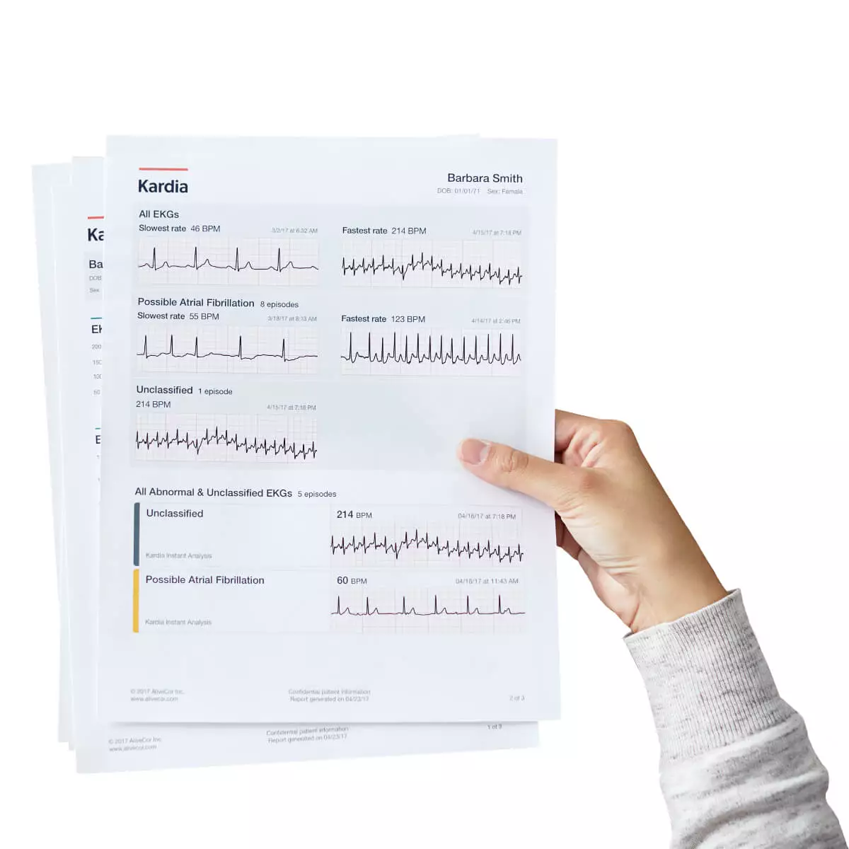  KardiaMobile® smartphone 1-channel ECG