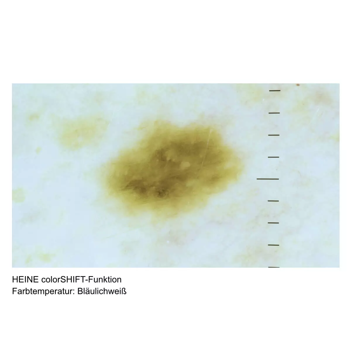 HEINE DELTA 30 PRO dermatoscope HEINE DELTA 30 PRO dermatoscope