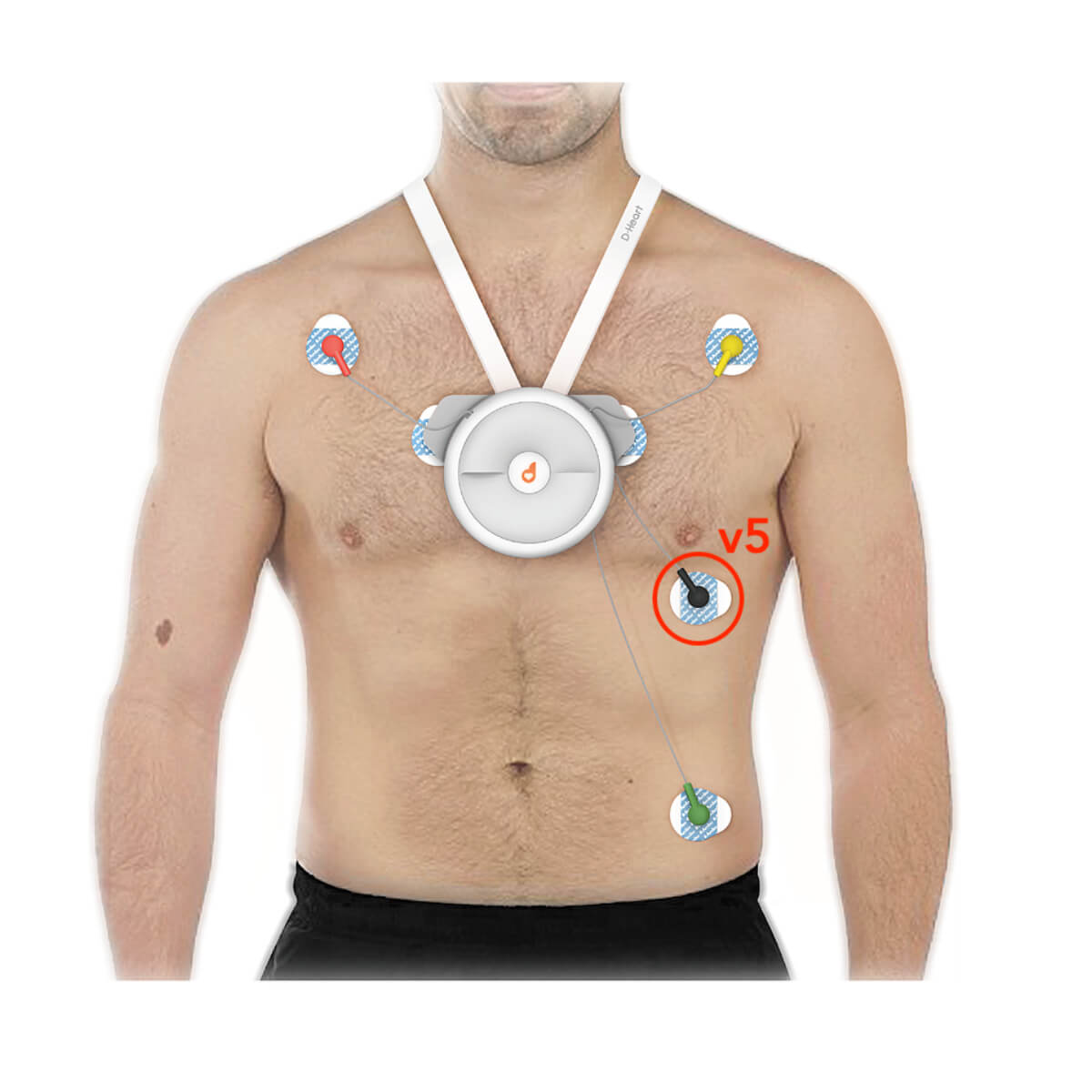D-Heart: Mobile 8- & 12-channel ECG device  D-Heart: Mobile 8- & 12-channel ECG device
