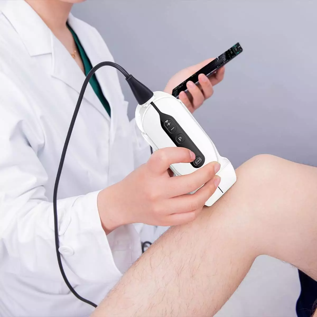  SonoEye G2 Handheld Ultrasound Scanner