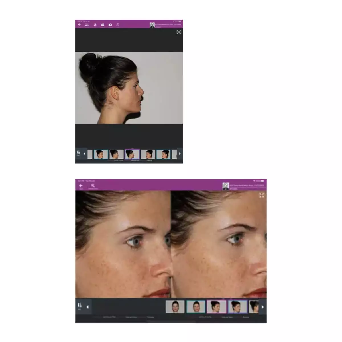  meesma photo system for iOS and FotoFinder Hub Cloud service