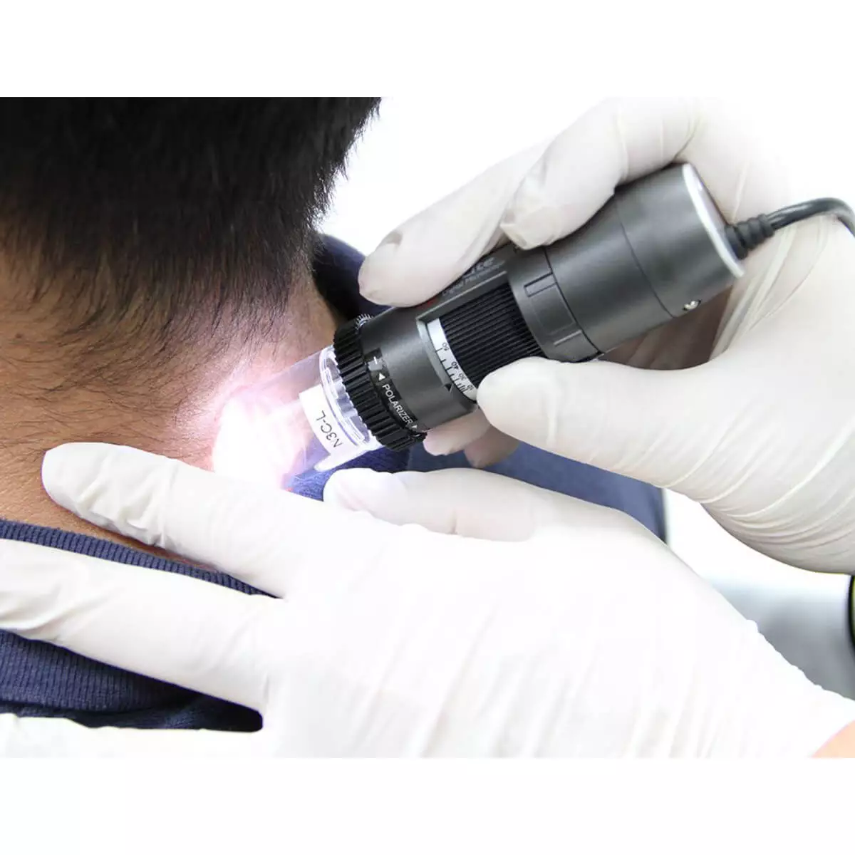  DermaScope Polarizer HR 200x video dermatoscope