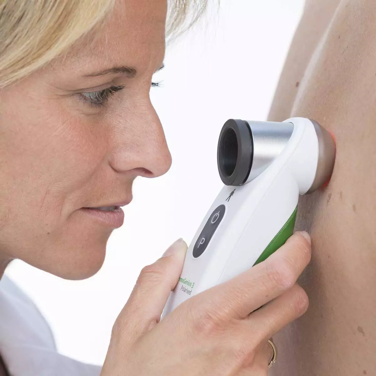  DermoGenius 3 Polarised Dermatoscope