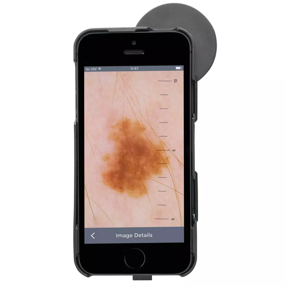  HEINE iC1 Dermatoscope