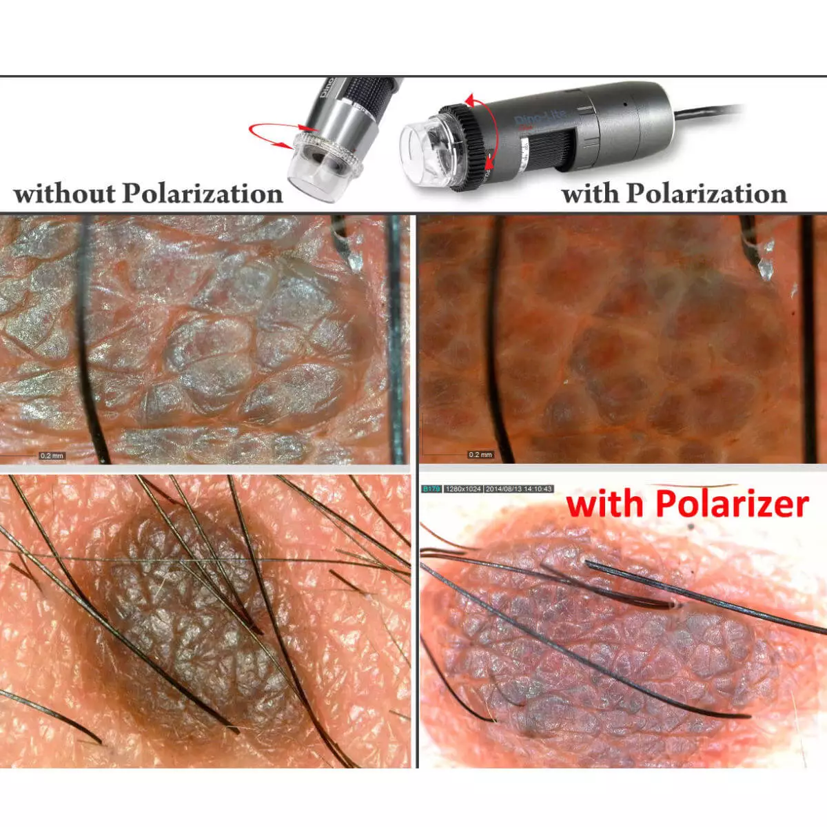  DermaScope Polarizer wireless video dermatoscope